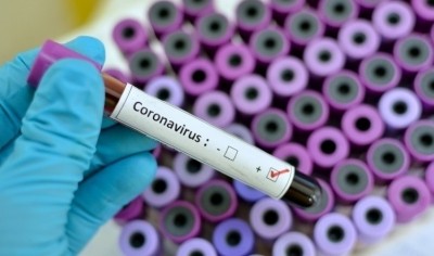 COVID-19 cases at 2 Sisters Coupar Angus has risen to 63